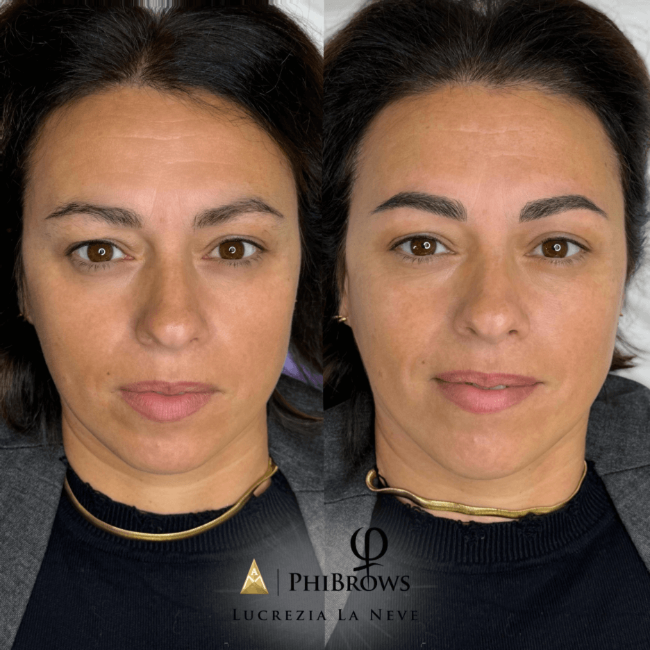 Esempio di risultato di microblading